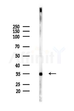 Annexin A2 Mouse Monoclonal Antibody - Western blot analysis of lysates from Hela cells(heat-shock 45min treatment), using Annexin A2 Mouse Monoclonal Antibody at 1/1000 dilution.