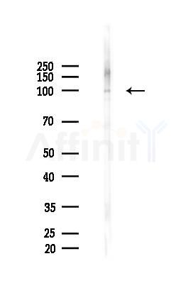 CTNND1 Mouse Monoclonal Antibody - Western blot analysis of lysates from 293 cells(UV 30min treatment), using CTNND1 Mouse Monoclonal Antibody at 1/1000 dilution.