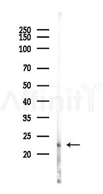 SOD2/MnSOD Mouse Monoclonal Antibody - Western blot analysis of lysates from Rat testis, using SOD2/MnSOD Mouse Monoclonal Antibody at 1/1000 dilution.