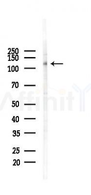 FOXM1 Mouse Monoclonal Antibody - Western blot analysis of lysates from Hela cells(heat-shock 45min treatment), using FOXM1 Mouse Monoclonal Antibody at 1/1000 dilution.