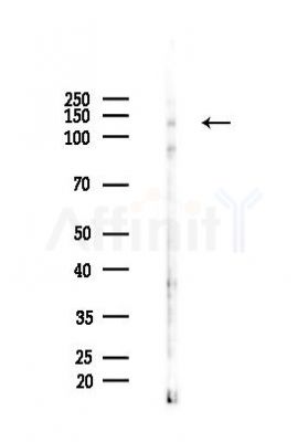 Phospho-CaSR (Thr888) Mouse Monoclonal Antibody - Western blot analysis of lysates from 293 cells(UV 30min treatment), using Phospho-CaSR (Thr888) Mouse Monoclonal Antibody at 1/1000 dilution.