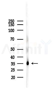 DKK1 Mouse Monoclonal Antibody - Western blot analysis of lysates from Mouse heart, using DKK1 Mouse Monoclonal Antibody at 1/1000 dilution.