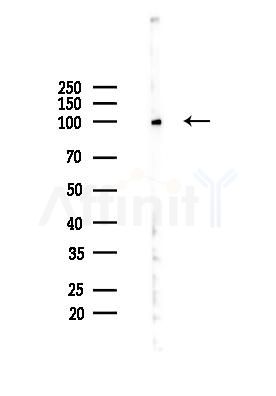 TrkC Mouse Monoclonal Antibody - Western blot analysis of lysates from Hela cells(heat-shock 45min treatment), using TrkC Mouse Monoclonal Antibody at 1/1000 dilution.