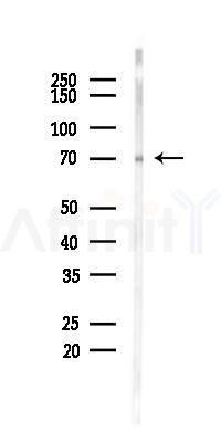 n-Myc Mouse Monoclonal Antibody - Western blot analysis of lysates from Rat brain, using n-Myc Mouse Monoclonal Antibody at 1/1000 dilution.