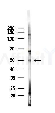ZIP7 Mouse Monoclonal Antibody - Western blot analysis of lysates from Hela cells(heat-shock 45min treatment), using ZIP7 Mouse Monoclonal Antibody at 1/1000 dilution.