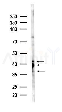 MKK3/MKK6 Mouse Monoclonal Antibody - Western blot analysis of lysates from 293 cells(UV 30min treatment), using MKK3/MKK6 Mouse Monoclonal Antibody at 1/1000 dilution.