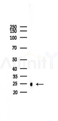 SOD2/MnSOD Mouse Monoclonal Antibody - Western blot analysis of lysates from Mouse heart, using SOD2/MnSOD Mouse Monoclonal Antibody at 1/1000 dilution.