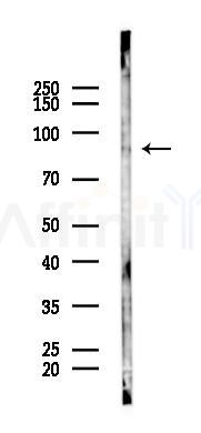 RXFP1 Mouse Monoclonal Antibody - Western blot analysis of lysates from COLO205 cells(heat-shock 45min treatment), using RXFP1 Mouse Monoclonal Antibody at 1/1000 dilution.