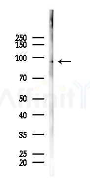 YTHDC1 Mouse Monoclonal Antibody - Western blot analysis of lysates from COLO205 cells(heat-shock 45min treatment), using YTHDC1 Mouse Monoclonal Antibody at 1/1000 dilution.