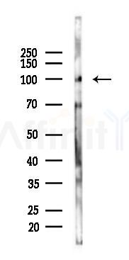 MCF2 Mouse Monoclonal Antibody - Western blot analysis of lysates from 293 cells(UV 30min treatment), using MCF2 Mouse Monoclonal Antibody at 1/1000 dilution.