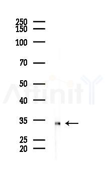 VSIG2 Mouse Monoclonal Antibody - Western blot analysis of lysates from COLO205 cells(heat-shock 45min treatment), using VSIG2 Mouse Monoclonal Antibody at 1/1000 dilution.
