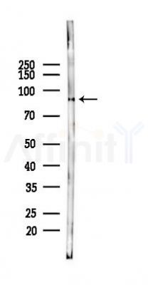 BAP1 Mouse Monoclonal Antibody - Western blot analysis of lysates from Hela cells(heat-shock 45min treatment), using BAP1 Mouse Monoclonal Antibody at 1/1000 dilution.