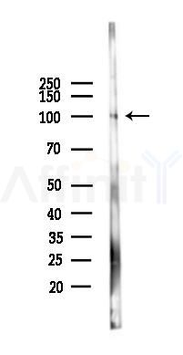 APP Mouse Monoclonal Antibody - Western blot analysis of lysates from Mouse heart, using APP Mouse Monoclonal Antibody at 1/1000 dilution.