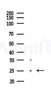 LSM1 Mouse Monoclonal Antibody - Western blot analysis of lysates from Rat brain, using LSM1 Mouse Monoclonal Antibody at 1/1000 dilution.
