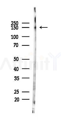 NMDAR2B Mouse Monoclonal Antibody - Western blot analysis of lysates from Rat brain, using NMDAR2B Mouse Monoclonal Antibody at 1/1000 dilution.