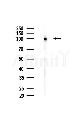YTHDC1 Mouse Monoclonal Antibody - Western blot analysis of lysates from Hela cells(heat-shock 45min treatment), using YTHDC1 Mouse Monoclonal Antibody at 1/1000 dilution.