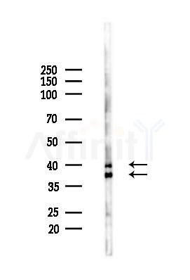 N myc interactor Mouse Monoclonal Antibody - Western blot analysis of lysates from Hela cells(heat-shock 45min treatment), using N myc interactor Mouse Monoclonal Antibody at 1/1000 dilution.