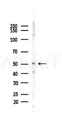MIDN Mouse Monoclonal Antibody - Western blot analysis of lysates from 293 cells(UV 30min treatment), using MIDN Mouse Monoclonal Antibody at 1/1000 dilution.