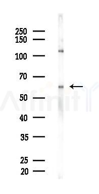 PUF60 Mouse Monoclonal Antibody - Western blot analysis of lysates from Hela cells(heat-shock 45min treatment), using PUF60 Mouse Monoclonal Antibody at 1/1000 dilution.