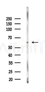 UGT2B15 Mouse Monoclonal Antibody - Western blot analysis of lysates from K562 cells(UV 30min treatment), using UGT2B15 Mouse Monoclonal Antibody at 1/1000 dilution.
