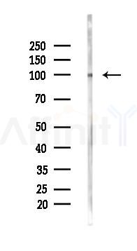 MGAT5 Mouse Monoclonal Antibody - Western blot analysis of lysates from K562 cells(UV 30min treatment), using MGAT5 Mouse Monoclonal Antibody at 1/1000 dilution.