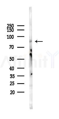 TRIM67 Mouse Monoclonal Antibody - Western blot analysis of lysates from Mouse heart, using TRIM67 Mouse Monoclonal Antibody at 1/1000 dilution.