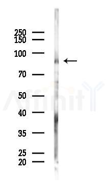 TBC1D12 Mouse Monoclonal Antibody - Western blot analysis of lysates from COLO205 cells(heat-shock 45min treatment), using TBC1D12 Mouse Monoclonal Antibody at 1/1000 dilution.