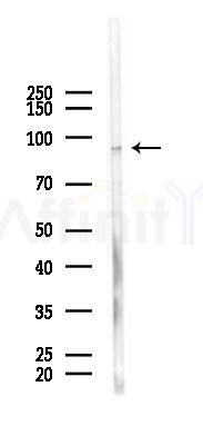 PRMT9 Mouse Monoclonal Antibody - Western blot analysis of lysates from COLO205 cells(heat-shock 45min treatment), using PRMT9 Mouse Monoclonal Antibody at 1/1000 dilution.