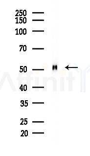 FAF2 Mouse Monoclonal Antibody - Western blot analysis of lysates from 293 cells(UV 30min treatment), using FAF2 Mouse Monoclonal Antibody at 1/1000 dilution.