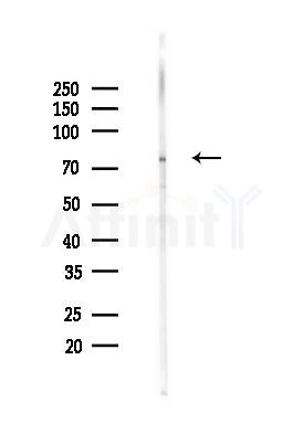 KIRREL2 Mouse Monoclonal Antibody - Western blot analysis of lysates from Rat heart, using KIRREL2 Mouse Monoclonal Antibody at 1/1000 dilution.