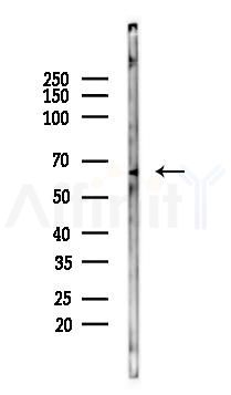MEX3D Mouse Monoclonal Antibody - Western blot analysis of lysates from Mouse heart, using MEX3D Mouse Monoclonal Antibody at 1/1000 dilution.