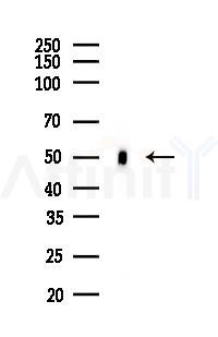 IKB beta Mouse Monoclonal Antibody - Western blot analysis of lysates from Rat brain, using IKB beta Mouse Monoclonal Antibody at 1/1000 dilution.