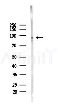 ADAM10 Mouse Monoclonal Antibody - Western blot analysis of lysates from Hela cells(heat-shock 45min treatment), using ADAM10 Mouse Monoclonal Antibody at 1/1000 dilution.