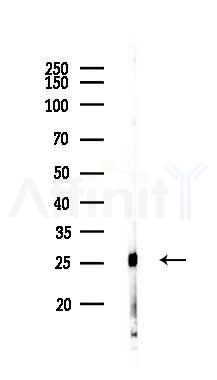Bcl-2 Antibody - Western blot analysis of lysates from Mouse heart, using Bcl-2 Antibody at 1/1000 dilution.