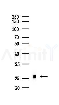 Bcl-2 Antibody - Western blot analysis of lysates from Rat testis, using Bcl-2 Antibody at 1/1000 dilution.