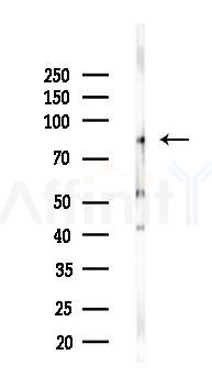 POSTN Mouse Monoclonal Antibody - Western blot analysis of lysates from K562 cells(UV 30min treatment), using POSTN Mouse Monoclonal Antibody at 1/1000 dilution.