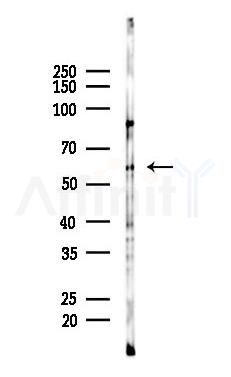 Cytochrome P450 2A6V2 Mouse Monoclonal Antibody - Western blot analysis of lysates from Rat testis, using Cytochrome P450 2A6V2 Mouse Monoclonal Antibody at 1/1000 dilution.