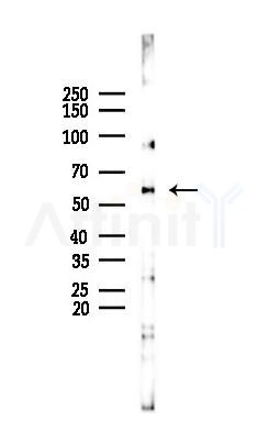 Cytochrome P450 2A6V2 Mouse Monoclonal Antibody - Western blot analysis of lysates from Hela cells(starvation 24h treatment), using Cytochrome P450 2A6V2 Mouse Monoclonal Antibody at 1/1000 dilution.