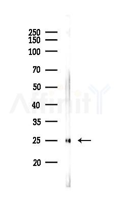 FGF13 Mouse Monoclonal Antibody - Western blot analysis of lysates from Rat muscle, using FGF13 Mouse Monoclonal Antibody at 1/1000 dilution.
