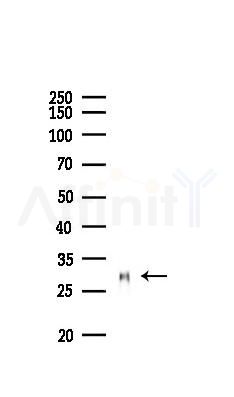 OR2F2 Mouse Monoclonal Antibody - Western blot analysis of lysates from Mouse liver, using OR2F2 Mouse Monoclonal Antibody at 1/1000 dilution.