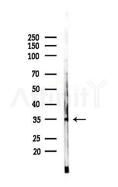UNG Mouse Monoclonal Antibody - Western blot analysis of lysates from COLO205 cells(UV 30min treatment), using UNG Mouse Monoclonal Antibody at 1/1000 dilution.