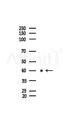 MBNL1 Mouse Monoclonal Antibody - Western blot analysis of lysates from COLO205 cells(UV 30min treatment), using MBNL1 Mouse Monoclonal Antibody at 1/1000 dilution.