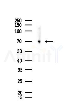 TLS/FUS Mouse Monoclonal Antibody - Western blot analysis of lysates from Mouse testis, using TLS/FUS Mouse Monoclonal Antibody at 1/1000 dilution.