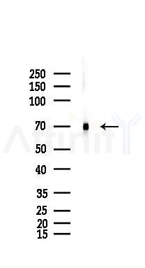 TLS/FUS Mouse Monoclonal Antibody - Western blot analysis of lysates from Mouse lung, using TLS/FUS Mouse Monoclonal Antibody at 1/1000 dilution.