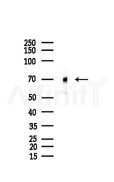 TLS/FUS Mouse Monoclonal Antibody - Western blot analysis of lysates from Rat testis, using TLS/FUS Mouse Monoclonal Antibody at 1/1000 dilution.