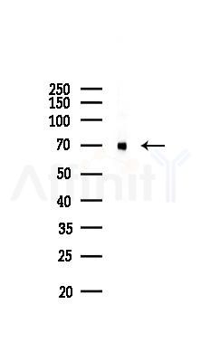 TLS/FUS Mouse Monoclonal Antibody - Western blot analysis of lysates from Hela cells(starvation 24h treatment), using TLS/FUS Mouse Monoclonal Antibody at 1/1000 dilution.