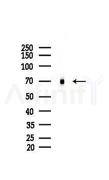 TLS/FUS Mouse Monoclonal Antibody - Western blot analysis of lysates from A2780 cells(LPS 4h treatment), using TLS/FUS Mouse Monoclonal Antibody at 1/1000 dilution.