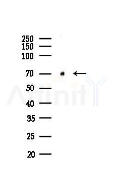 TLS/FUS Mouse Monoclonal Antibody - Western blot analysis of lysates from K562 cells(heat-shock 45min treatment), using TLS/FUS Mouse Monoclonal Antibody at 1/1000 dilution.