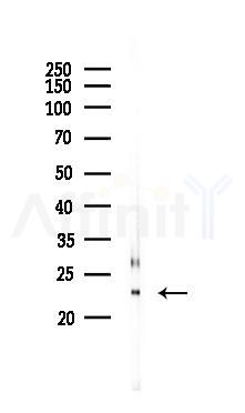 ARL11 Mouse Monoclonal Antibody - Western blot analysis of lysates from Rat muscle, using ARL11 Mouse Monoclonal Antibody at 1/1000 dilution.