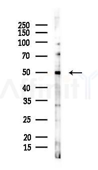 EF-Tu Mouse Monoclonal Antibody - Western blot analysis of lysates from COLO205 cells(UV 30min treatment), using EF-Tu Mouse Monoclonal Antibody at 1/1000 dilution.